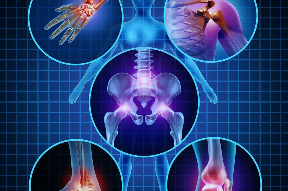 Vertebral Fractures